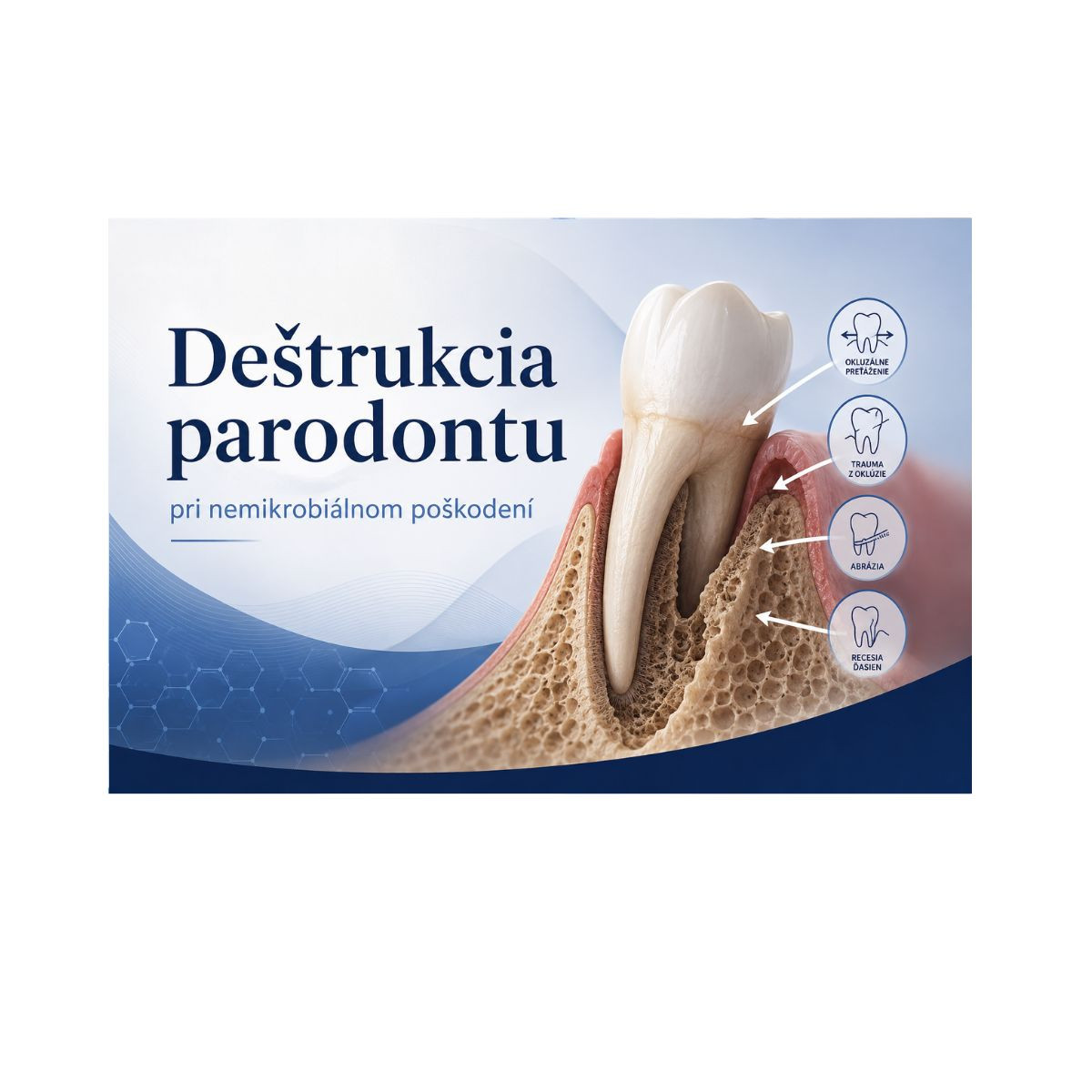 Deštrukcia parodontu pri nemikrobiálnom poškodení